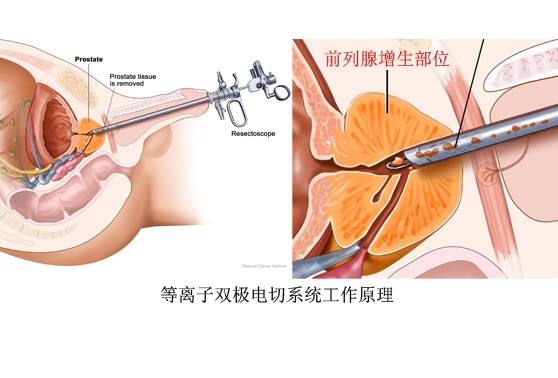 体检未及时将结果告知医院主动担责